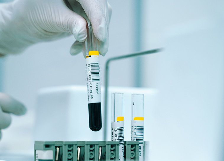 a hand holding a test tube with a black liquid