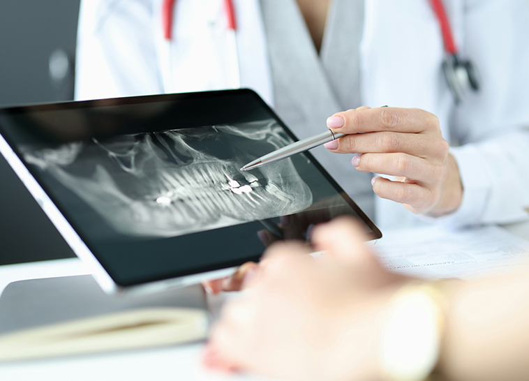 a doctor showing a x-ray of a jaw